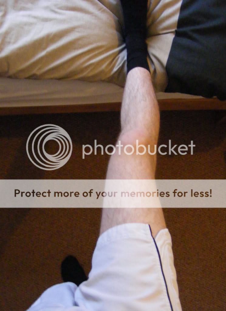 Bad knees for cycling? (Pictures) Bike Forums