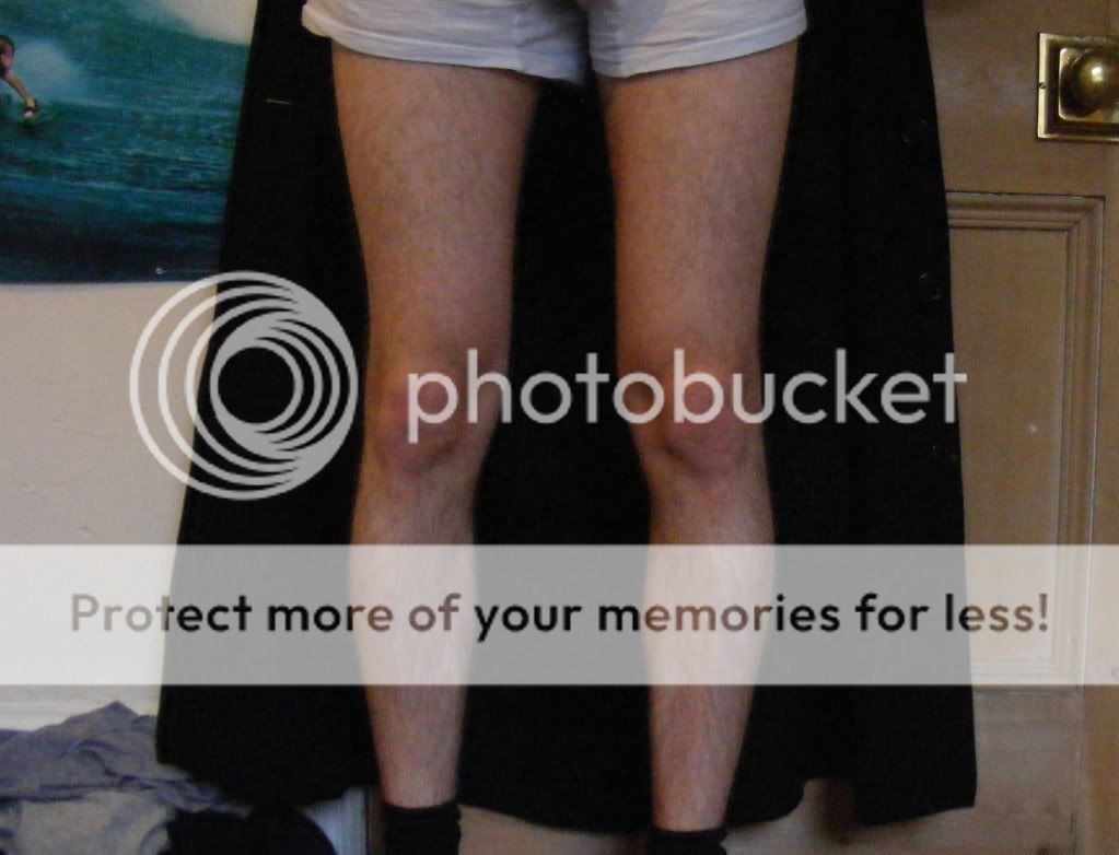 Bad knees for cycling? (Pictures) Bike Forums